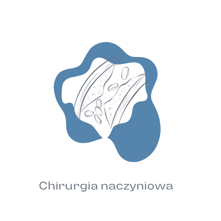 Chirurgia naczyniowa